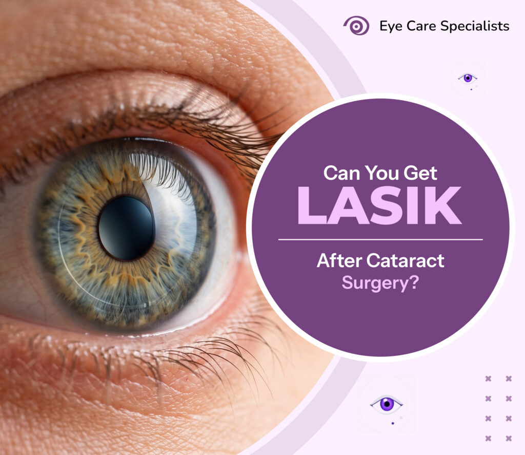 an You Get LASIK After Cataract Surgery